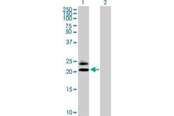 MS4A5 抗体  (AA 1-200)