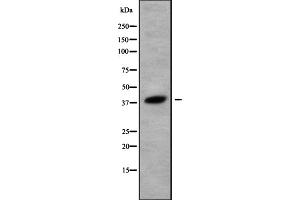 Western blot analysis Olfactory receptor 52K1 using 293 whole cell lysates (OR52K1 抗体)