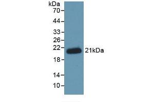 Detection of Recombinant HJV, Human using Monoclonal Antibody to Hemojuvelin (HJV)