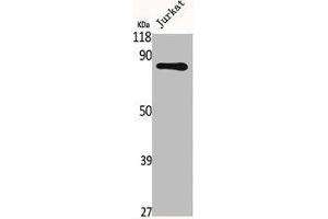 Western Blot analysis of Jurkat cells using Fyb Polyclonal Antibody (FYB1 抗体  (C-Term))