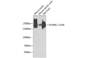 Western blot analysis of extracts of various cell lines using NCAM1 / CD56 Polyclonal Antibody at dilution of 1:1000. (CD56 抗体)