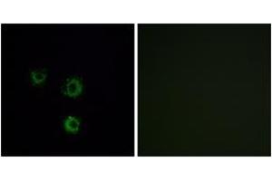 Immunofluorescence analysis of MCF7 cells, using TAS2R14 Antibody. (TAS2R14 抗体  (AA 229-278))