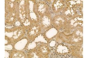 RIC3 Mouse Monoclonal Antibody at 1/100 staining human normal kidney tissue by IHC-P.
