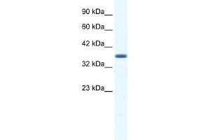 WB Suggested Anti-ANXA3 Antibody Titration:  1. (Annexin A3 抗体  (C-Term))