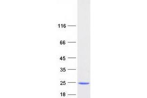 Western Blotting (WB) image for CGG Triplet Repeat Binding Protein 1 (CGGBP1) (Transcript Variant 2) protein (Myc-DYKDDDDK Tag) (ABIN2713944)