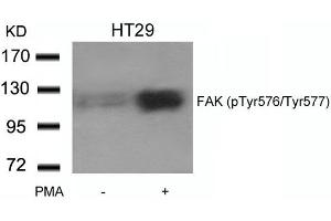 Western blot analysis of extracts from HT29 cells untreated or treated with PMA using FAK(phospho-Tyr576/Tyr577) Antibody. (FAK 抗体  (pTyr576, pTyr577))