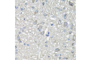 Immunohistochemistry of paraffin-embedded rat brain using GFPT1 antibody at dilution of 1:100 (x40 lens). (GFPT1 抗体)