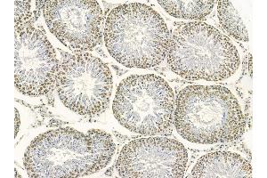 MKK3/MKK6 Mouse Monoclonal Antibody at 1/100 staining rat testis tissue by IHC-P.