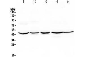 Western blot analysis of HMBS using anti-HMBS antibody . (HMBS 抗体  (AA 6-361))