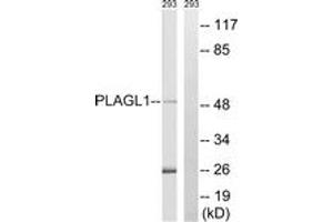 Western blot analysis of extracts from 293 cells, using PLAGL1 Antibody. (PLAGL1 抗体  (AA 311-360))