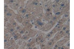 IHC-P analysis of Human Liver Tissue, with DAB staining. (APAF1 抗体  (AA 31-350))