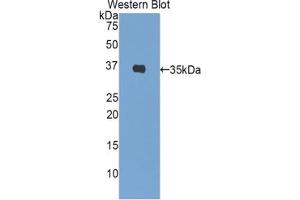 Western blot analysis of the recombinant protein. (Insulin 抗体  (AA 88-108))