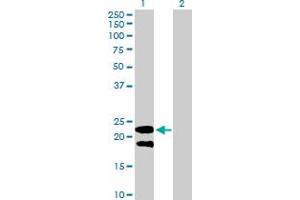 Western Blot analysis of LY6G5B expression in transfected 293T cell line by LY6G5B MaxPab polyclonal antibody. (LY6G5B 抗体  (AA 1-201))