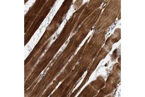 Immunohistochemical staining of human skeletal muscle with SOBP polyclonal antibody  shows strong cytoplasmic positivity in myocytes at 1:200-1:500 dilution. (SOBP 抗体)