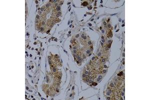 Immunohistochemistry of paraffin-embedded human stomach using TNFRSF6B antibody (ABIN5970241) at dilution of 1/200 (40x lens). (TNFRSF6B 抗体)