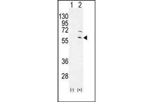 Western blot analysis of RPS6KL1 (arrow) using RPS6KL1 Antibody . (RPS6KL1 抗体)