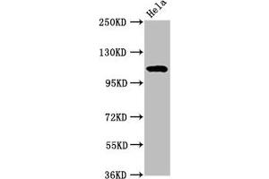 Western Blot Positive WB detected in: Hela whole cell lysate All lanes:NAT10 antibody at 7 μg/mL Secondary Goat polyclonal to rabbit IgG at 1/50000 dilution Predicted band size: 116, 108 kDa Observed band size: 116 kDa (NAT1 抗体  (AA 909-1025))