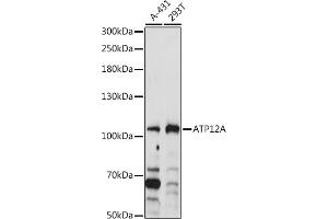Western blot analysis of extracts of various cell lines, using A antibody (ABIN7265768) at 1:1000 dilution. (ATP12A 抗体  (AA 890-980))