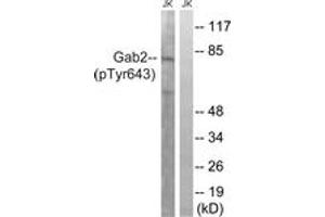 Western blot analysis of extracts from Jurkat cells treated with IFN 2500U/ML 30', using Gab2 (Phospho-Tyr643) Antibody. (GAB2 抗体  (pTyr643))