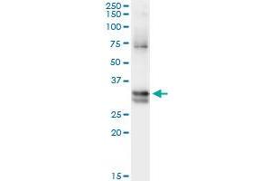 Immunoprecipitation of NIT1 transfected lysate using anti-NIT1 monoclonal antibody and Protein A Magnetic Bead , and immunoblotted with NIT1 monoclonal antibody. (Nitrilase 1 抗体  (AA 228-327))