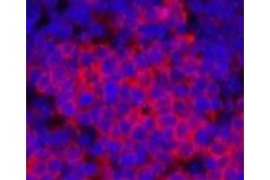 Immunofluorescence analysis of Rat spleen tissue using Cleaved-PARP1 (D214) Polyclonal Antibody at dilution of 1:200. (PARP1 抗体  (Cleaved-Asp214))