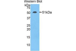 Western blot analysis of the recombinant protein. (TFAM 抗体  (AA 43-244))