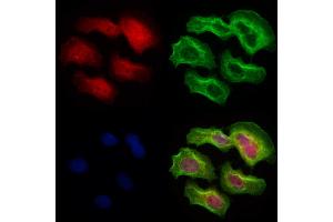 ABIN6265289 and ABIN6273076 staining Hela cells by IF/ICC. (SRP68 抗体  (C-Term))