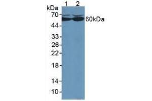 Western blot analysis of (1) Human HepG2 Cells and (2) Human HeLa cells. (Catalase 抗体  (AA 80-239))