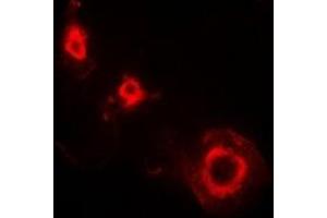 Immunofluorescent analysis of Ferritin L staining in HepG2 cells. (Ferritin L 抗体)
