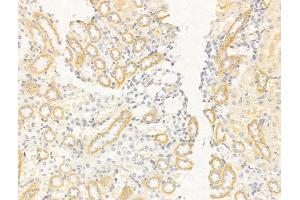 ABIN6261605 and ABIN6268755 at 1/100 staining Rat kidney tissue by IHC-P. (EpCAM 抗体  (Internal Region))
