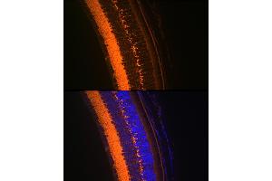Immunofluorescence analysis of mouse eye using V Rabbit mAb (ABIN7271313) at dilution of 1:100 (40x lens). (VAMP2 抗体)