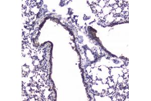 IHC testing of FFPE mouse lung tissue with PDE4D antibody.