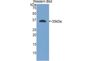 Western blot analysis of the recombinant protein. (Integrin beta 4 抗体  (AA 923-1197))