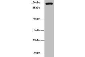 Western blot All lanes: INVS antibody IgG at 14 μg/mL + K562 whole cell lysate Secondary Goat polyclonal to rabbit IgG at 1/10000 dilution Predicted band size: 118, 100, 11 kDa Observed band size: 118 kDa (Inversin 抗体  (AA 1-101))