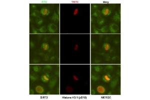 Immunocytochemistry (ICC) image for anti-Sirtuin 2 (SIRT2) antibody (ABIN4953430)