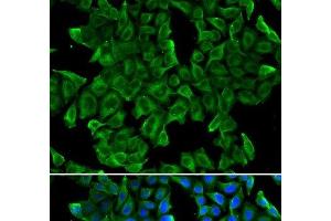 Immunofluorescence analysis of MCF-7 cells using REG3G Polyclonal Antibody (REG3g 抗体)
