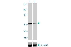 Western Blotting (WB) image for anti-TGFB-Induced Factor Homeobox 2 (TGIF2) (AA 131-236) antibody (ABIN566207)