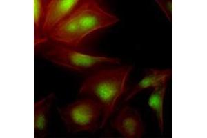 Immunofluorescenitrocellulosee of human HeLa cells stained with Phalloidin-TRITC (Red) for Actin staining and monoclonal anti-human UBE2S antibody (1:500) with Alexa 488 (Green). (UBE2S 抗体  (AA 1-222))