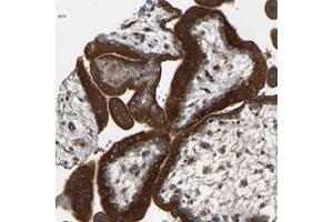 Immunohistochemical staining of human placenta with PTCD1 polyclonal antibody  shows strong cytoplasmic positivity in trophoblastic cells. (PTCD1 抗体)