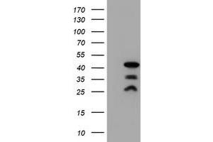 Western Blotting (WB) image for anti-PDZ and LIM Domain 2 (PDLIM2) antibody (ABIN1500127) (PDLIM2 抗体)
