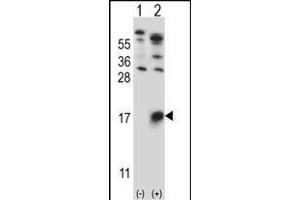 Western blot analysis of GYPB (arrow) using rabbit polyclonal GYPB Antibody (Center) (ABIN657621 and ABIN2846617). (CD235b/GYPB 抗体  (AA 22-51))