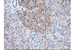 Immunohistochemical staining of paraffin-embedded Human Kidney tissue using anti-TTC32 mouse monoclonal antibody. (TTC32 抗体)