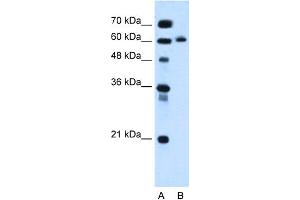 WB Suggested Anti-KIAA1754L Antibody Titration:  0. (ITPRIPL1 抗体  (C-Term))