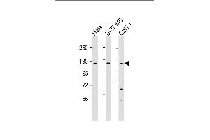 All lanes : Anti-STARD8 Antibody (N-Term) at 1:1000-1:2000 dilution Lane 1: Hela whole cell lysate Lane 2: U-87 MG whole cell lysate Lane 3: Caki-1 whole cell lysate Lysates/proteins at 20 μg per lane. (STARD8 抗体  (AA 220-255))