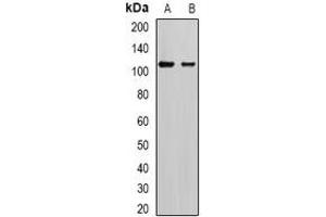 Western blot analysis of AP2-alpha-2 expression in SKOV3 (A), mouse brain (B) whole cell lysates. (AP2A2 抗体)