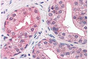 Prostate: Formalin-Fixed, Paraffin-Embedded (FFPE) (LMO4 抗体  (AA 115-127))