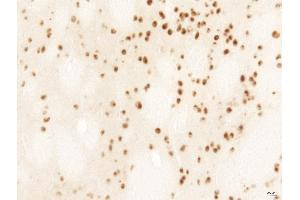 Rat LV-Htt171-82Q (800 ng) PFA 4% HTT Ab, 1/2,000 PBS-BSA 1% - 25 µm. (Huntingtin 抗体  (AA 85-200))