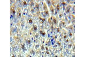 Used in DAB staining on fromalin fixed paraffin-embedded Liver tissue (SSRP1 抗体  (AA 6-246))