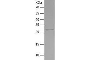 Western Blotting (WB) image for Secreted Frizzled-Related Protein 5 (SFRP5) (AA 22-314) protein (His tag) (ABIN7289427) (SFRP5 Protein (AA 22-314) (His tag))