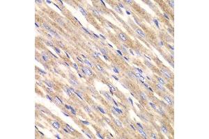 Immunohistochemistry of paraffin-embedded rat heart using SLC25A4 antibody. (SLC25A4 抗体  (AA 40-298))